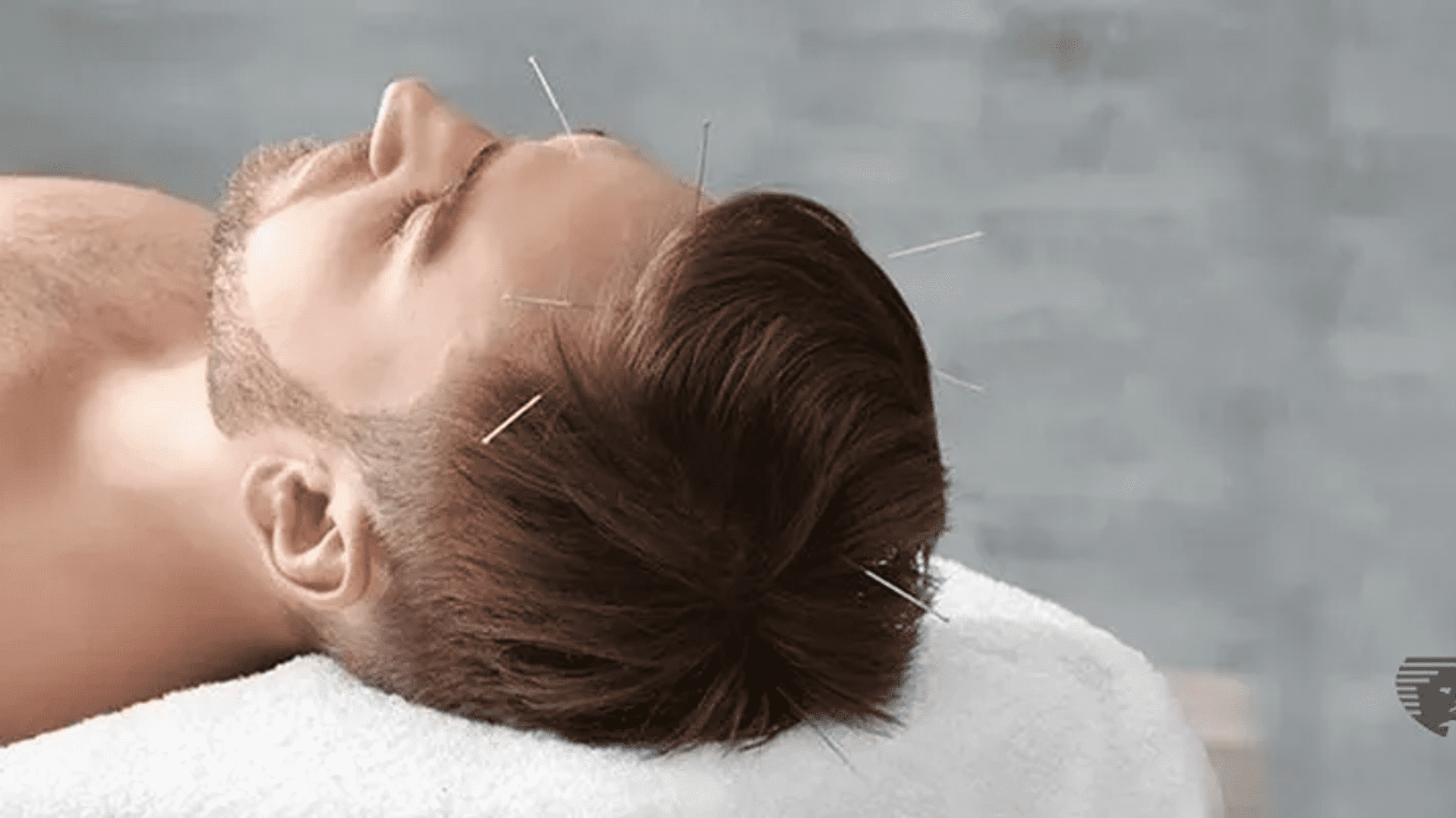 How To Reverse Male Pattern Baldness